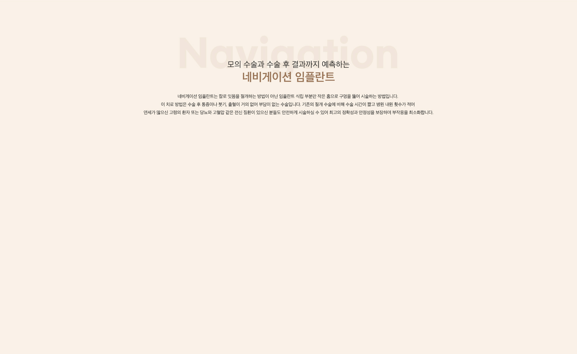 3D 내비게이션 임플란트
